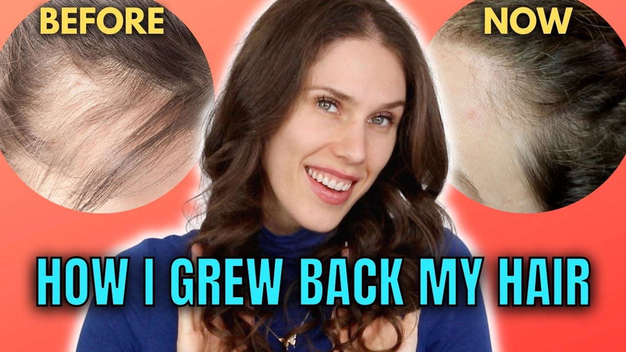 Top 5 Hair Growth Serums NEWEST / AB TEST